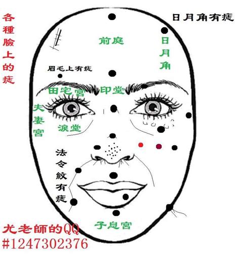 面相學 痣|臉上長痣別亂點！超準面相學：「這顆痣」一輩子不愁吃穿、脖子。